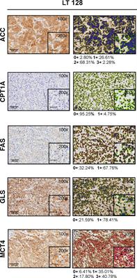 Metabolic classification of non-small cell lung cancer patient-derived xenografts by a digital pathology approach: A pilot study